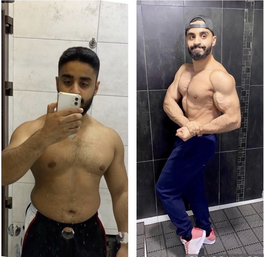 نتيجة عميل حقيقية - قبل وبعد